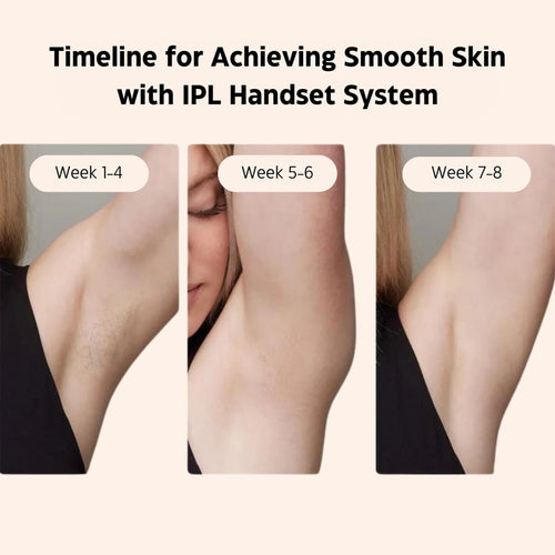 Laser Hair Removal System